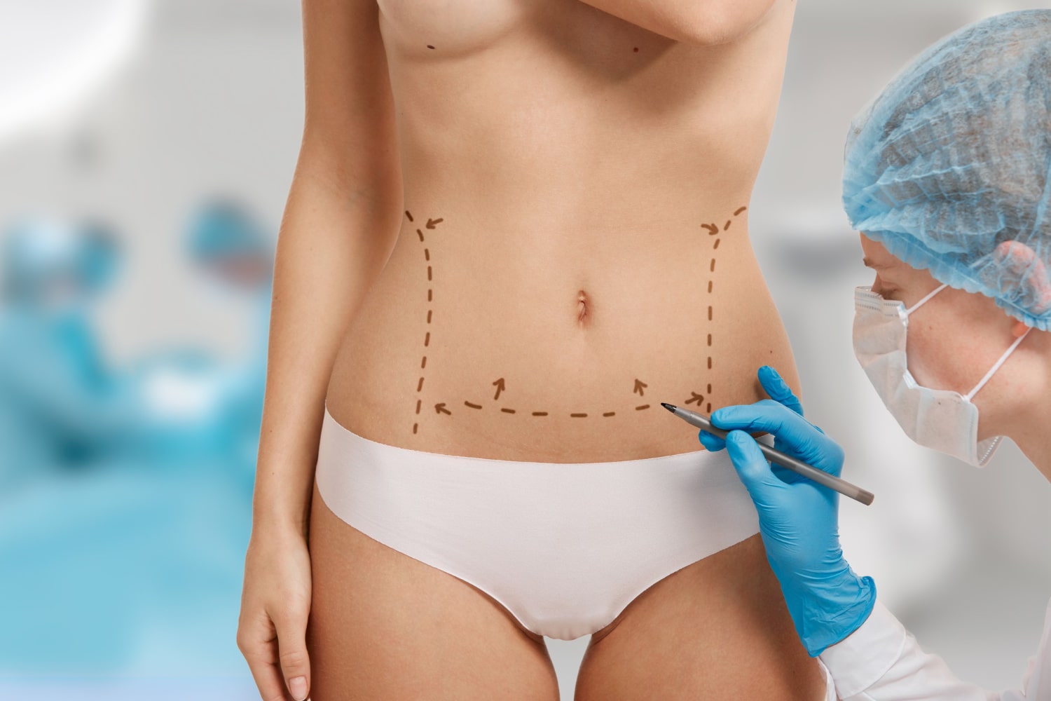 eliminación de piel sobrante en abdomen tras embarazo